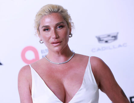 Kesha