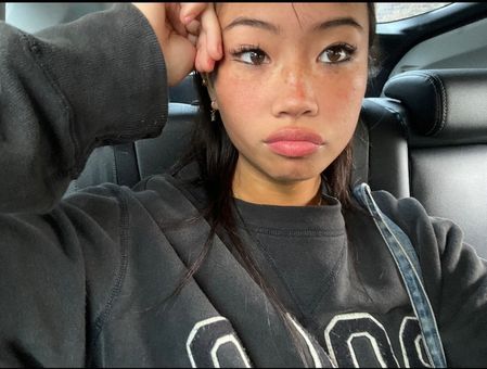 Radvxz